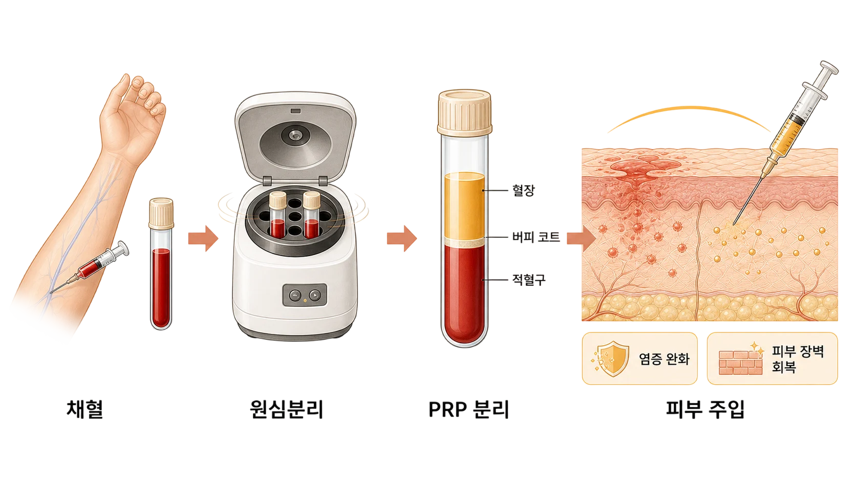 알러지성 접촉 피부염 관리