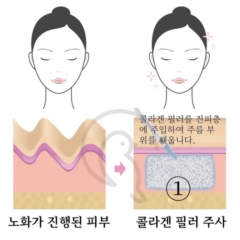 스킨부스터 가이드 — 내 피부에 맞는 스킨부스터 찾기